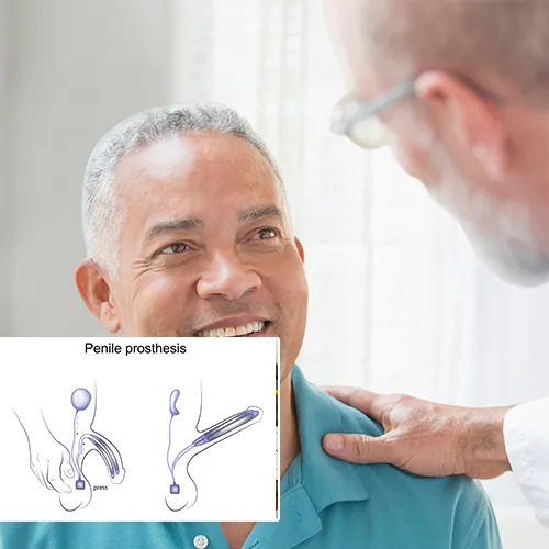 Embracing Life with a Penile Implant